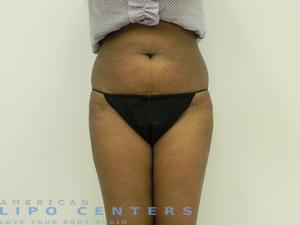 americanlipocenters_76.jpg